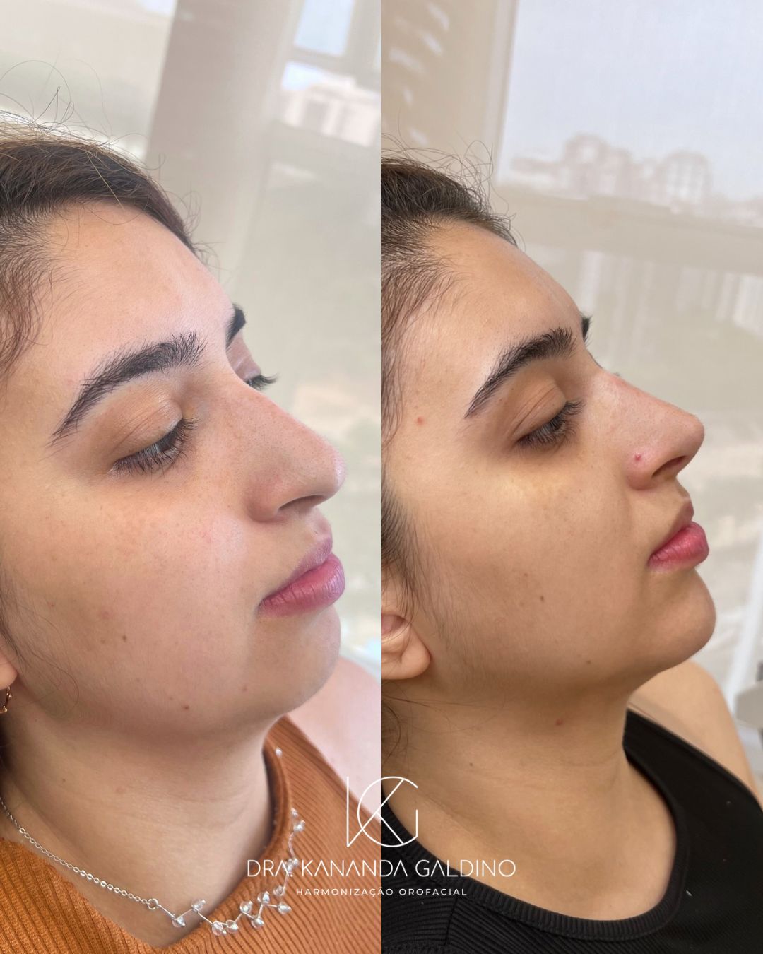 Resultado de paciente 1