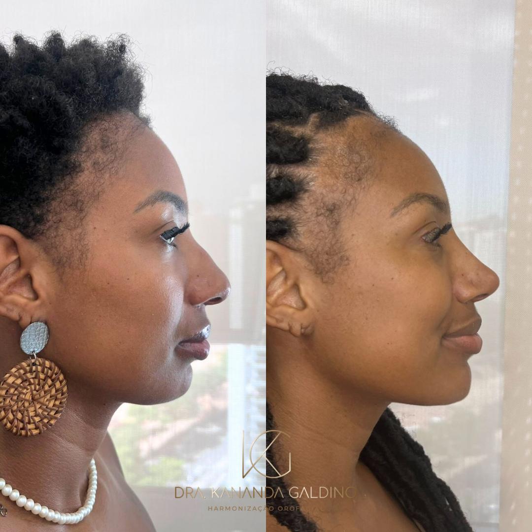 Resultado de paciente 2