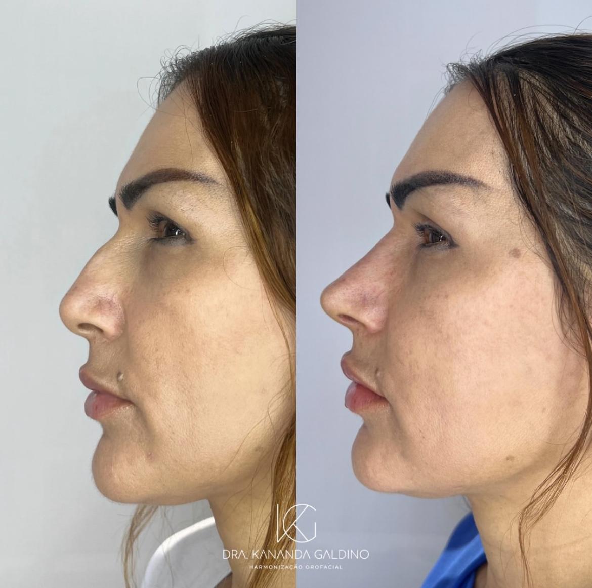 Resultado de paciente 3