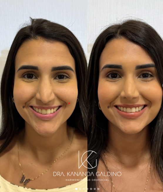 Resultado de paciente 4