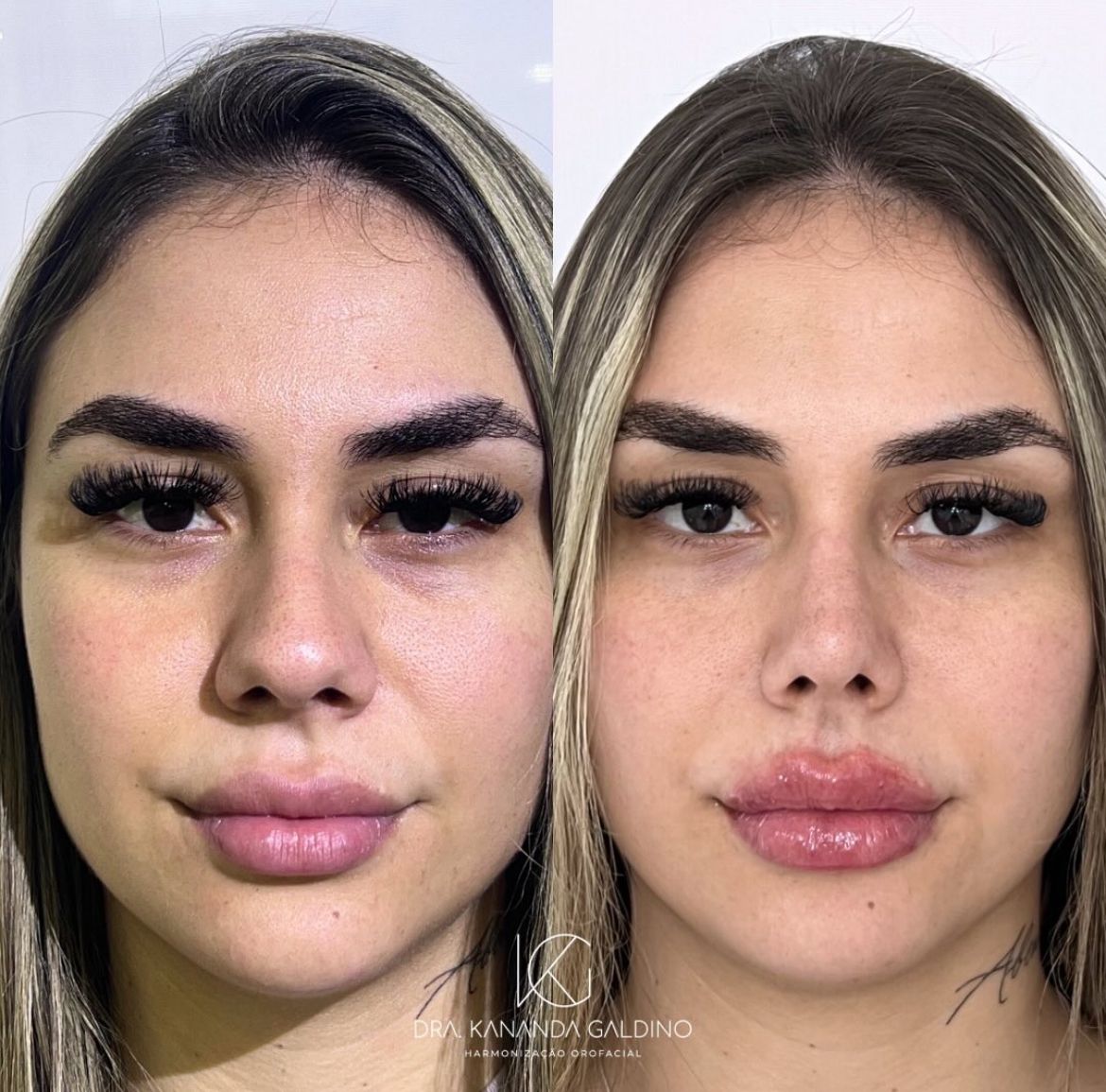 Resultado de paciente 5