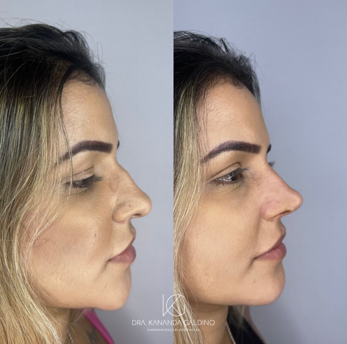 Resultado de paciente 6