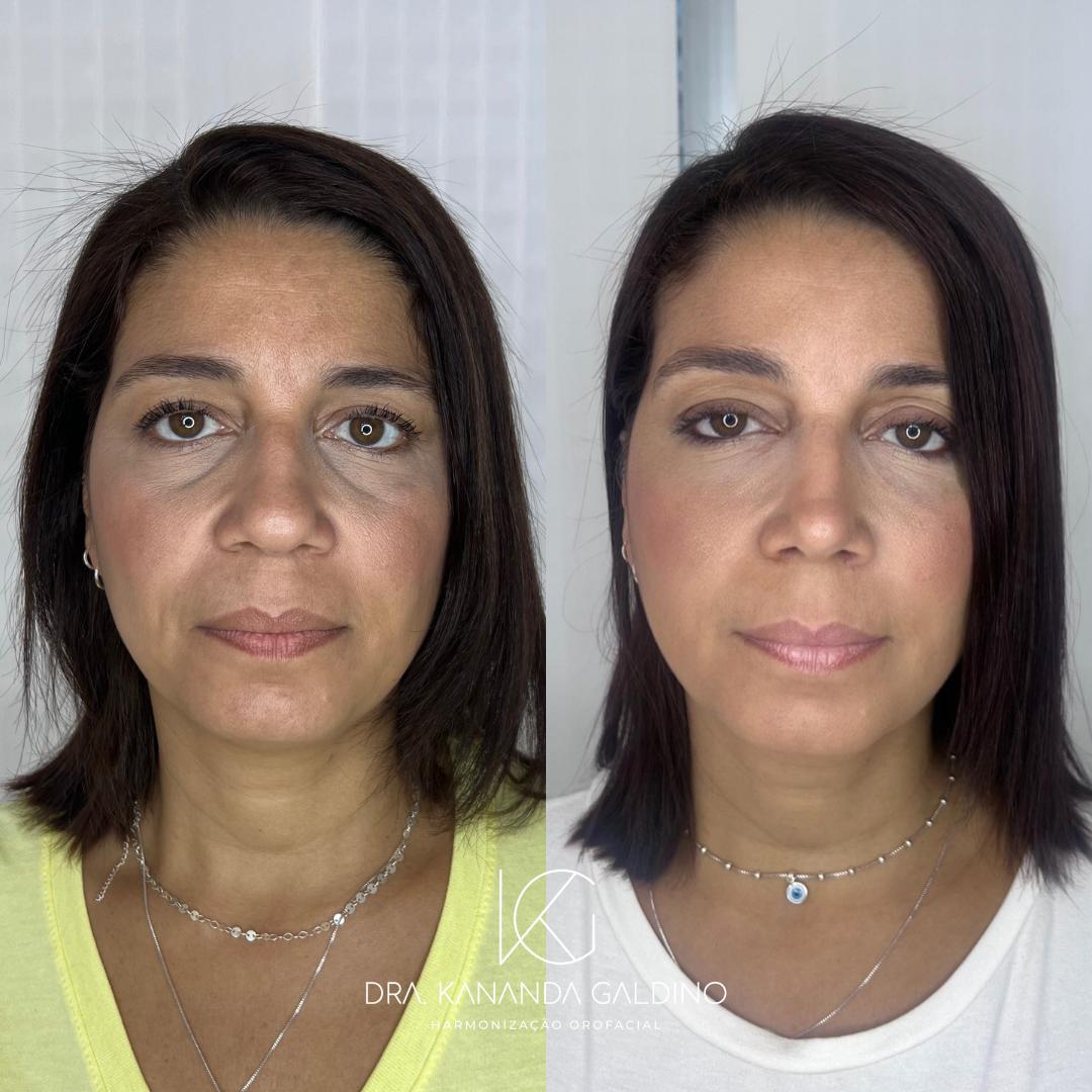 Resultado de paciente 7